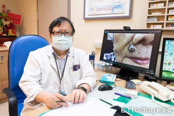 ▲▼ 黑色版點可能是皮膚癌，醫生建議可以看腳底 。（圖／嘉義長庚提供）