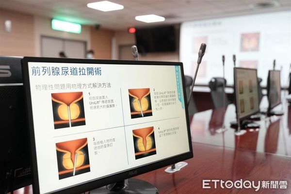 ▲▼     治療攝護腺肥大的新選擇 嘉義長庚引進UroLift療法，嘉義長庚泌尿科 黃國財醫師     。（圖／嘉義長庚提供）